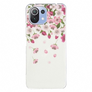 Coque Xiaomi 11 Lite 5G NE / Mi 11 Lite / Lite 5G Fluorescente Fleurs