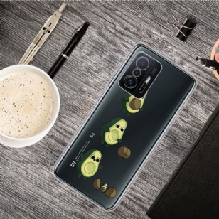 Coque Xiaomi 11T / 11T Pro illustration avocat