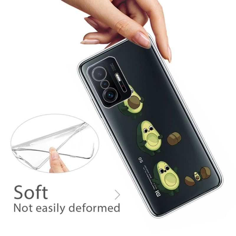 Coque Xiaomi 11T / 11T Pro illustration avocat